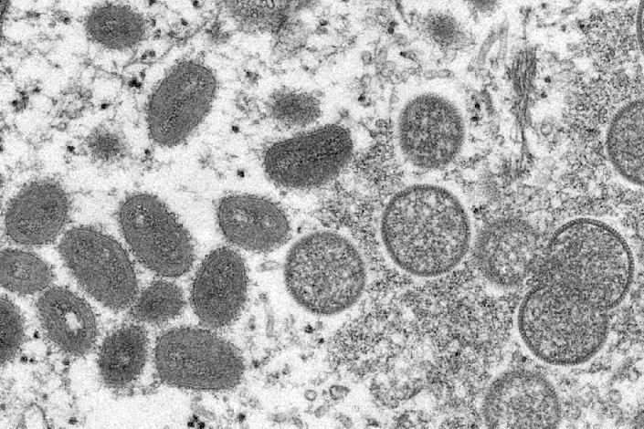 An electron micrograph showing both oval and round monkeypox virions.