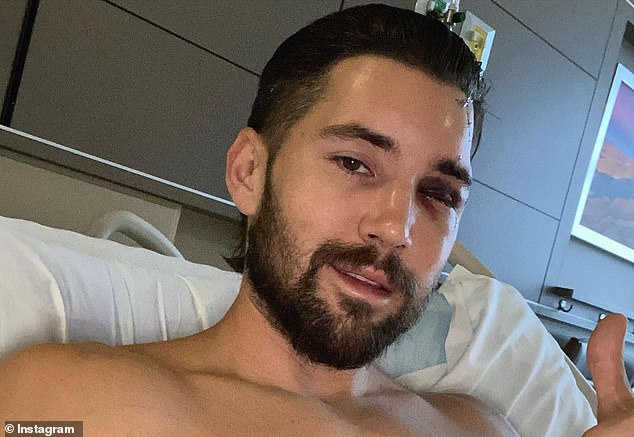 Wittek underwent at least nine surgeries after the accident.  Not only did he crush his skull, but he almost lost his eye as well