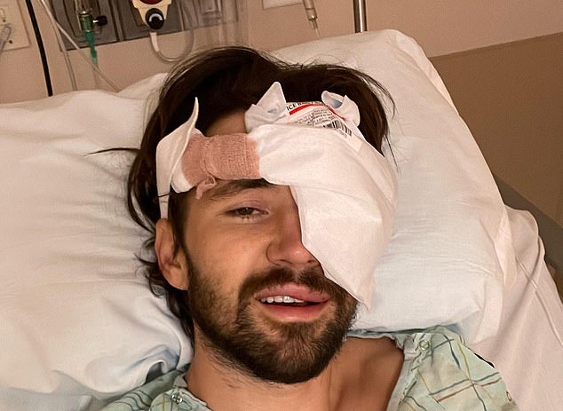 Jeff Wittek, 32, in hospital after crushing his skull in nine places and nearly losing his eye in a YouTube stunt gone awry.  He blames YouTuber Dave Dobrik for the injury
