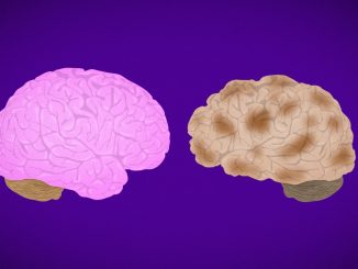 The fight against Alzheimer's: where do we stand now?