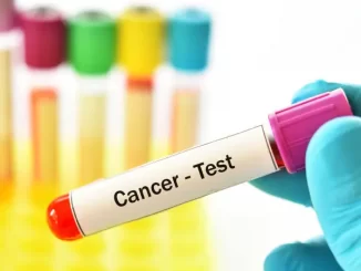 vial of blood labeled 'cancer test'