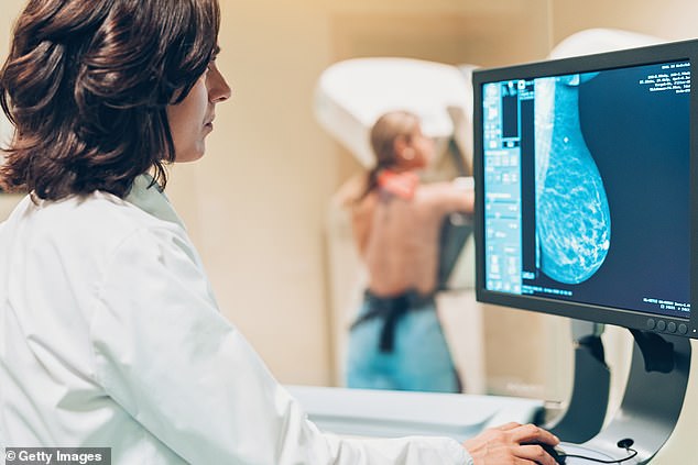 Thousands of women with breast cancer could be spared unnecessary chemotherapy thanks to new artificial intelligence technology