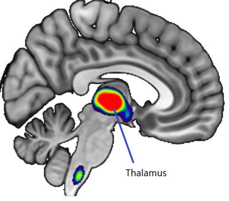 This shows the location of the thalamus in the brain