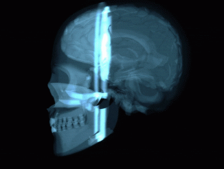 3D Brain Scan Side View